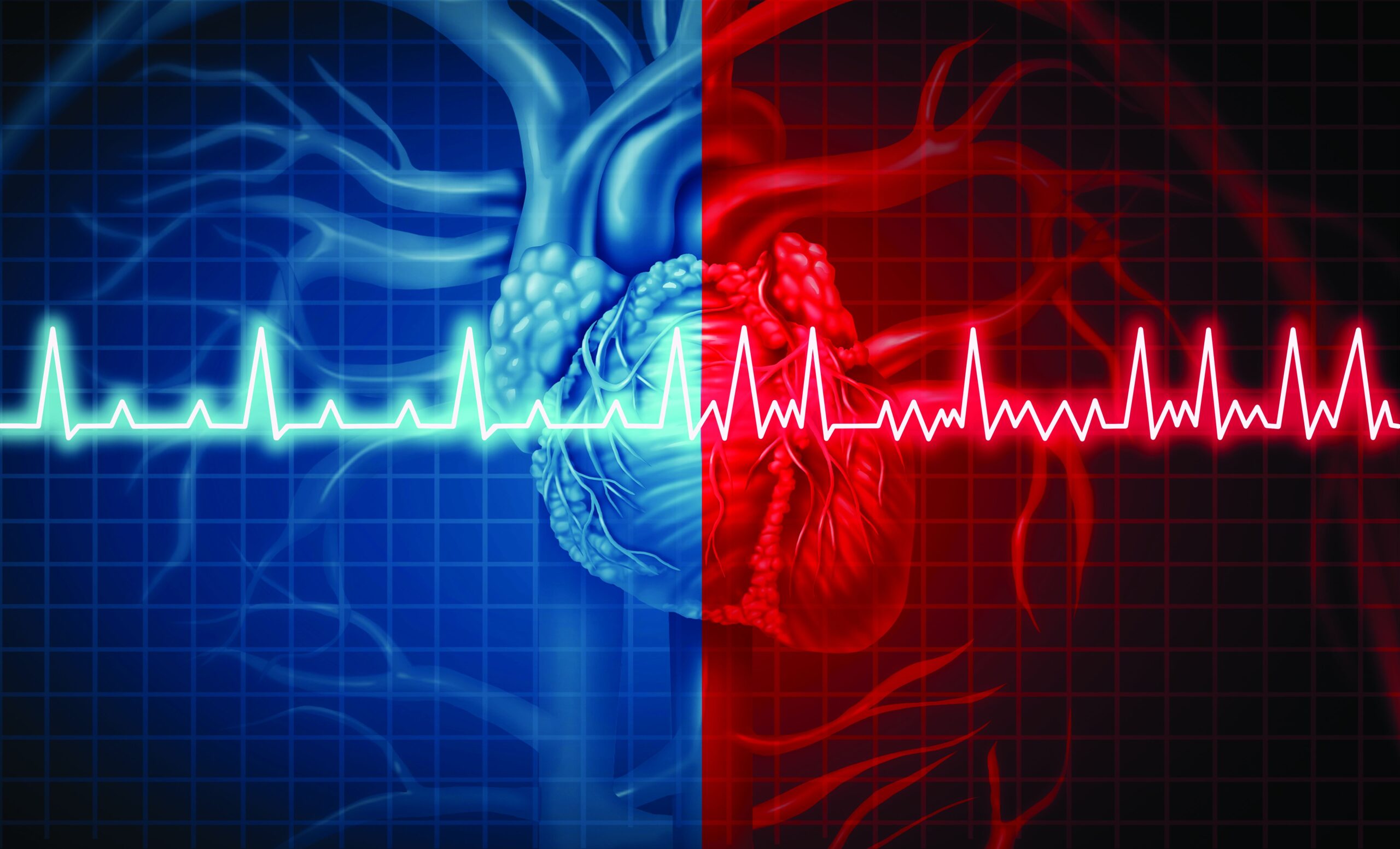 Vitamin D supplement reduces risk of Atrial Fibrillation