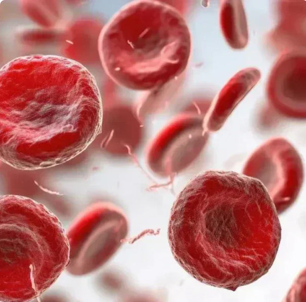 Anemia / Iron Deficiency Diet Plan